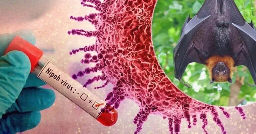 Wabah Nipah di India Picu Kewaspadaan Regional, Indonesia Siaga 1 Nipah