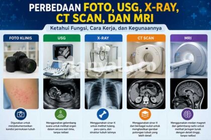 Mengenal Perbedaan Foto, USG, X-Ray, CT Scan, dan MRI, Jangan Sampai Keliru.